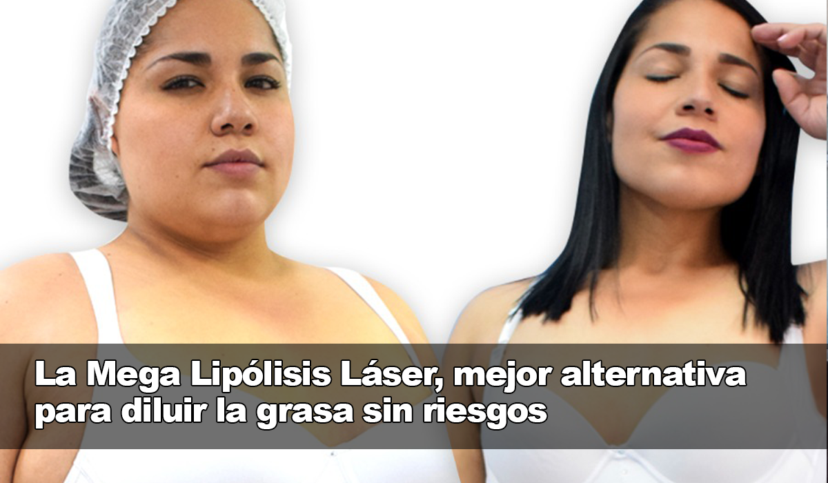 ¡Elimina la grasa no deseada con la Mega Lipólisis Láser!